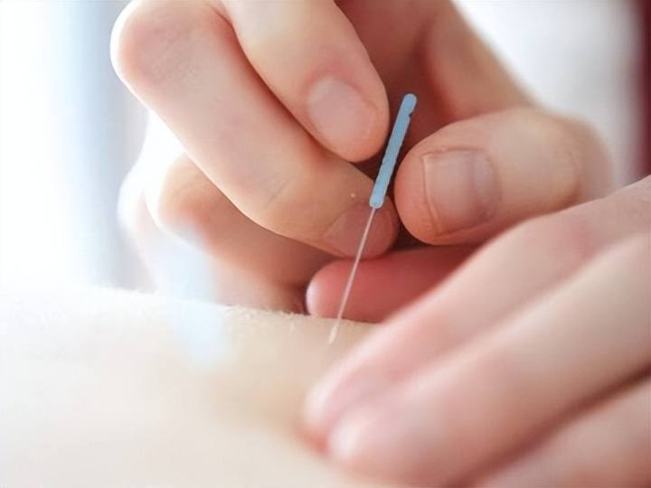 【健康知识】肢体疼痛的微针治疗_沈阳卫生健康