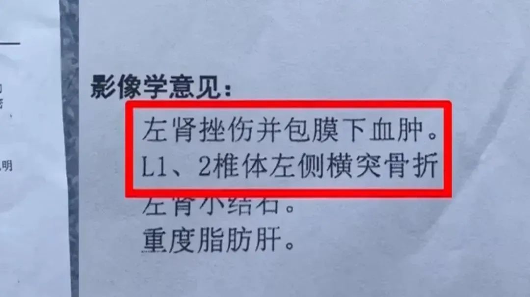 小心！男子被天降“大叶”砸成骨折