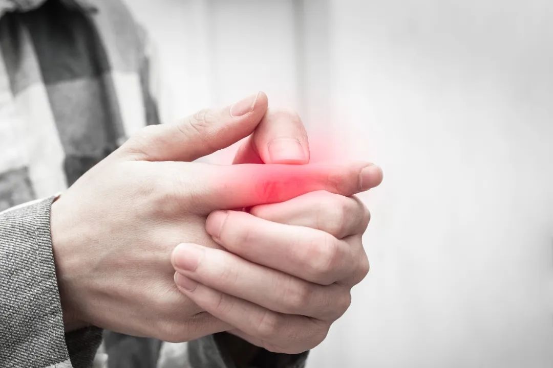 患有手指关节疼痛的男人的手图片素材